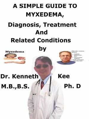 cover image of A Simple Guide to Myxedema, Diagnosis, Treatment and Related Conditions